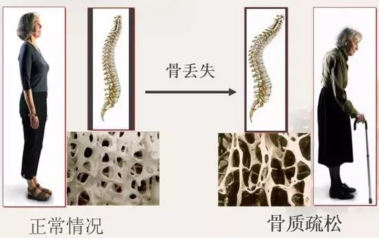 女性补钙(补钙女性吃奶粉还是钙片好)-硒宝网