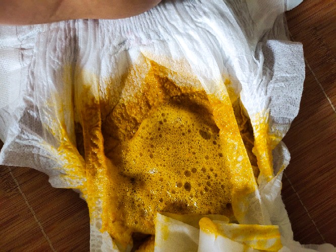 宝宝怎么补钙(三个月宝宝补钙)-硒宝网