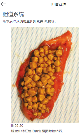 补钙的食物(食物补钙有哪些食物是最好)-硒宝网