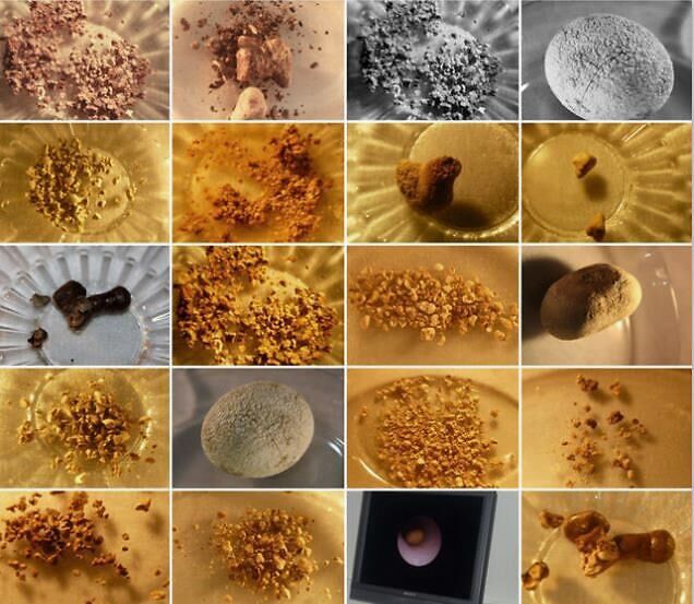 补钙的食物(食物补钙有哪些食物是最好)-硒宝网