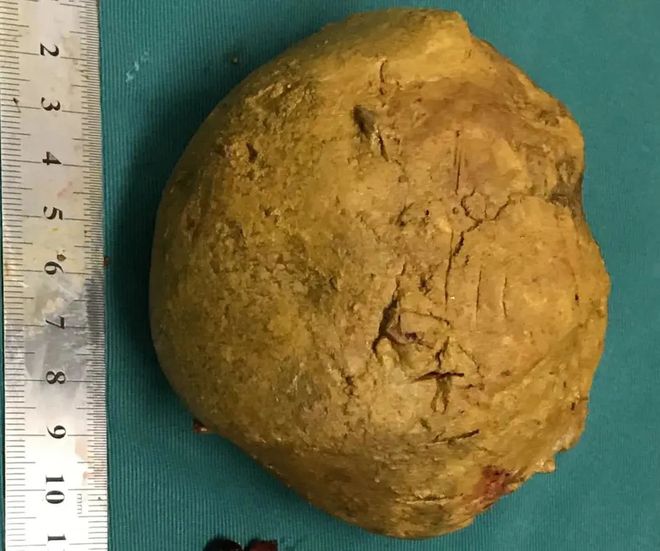 补钙的食物(食物补钙有哪些食物是最好)-硒宝网