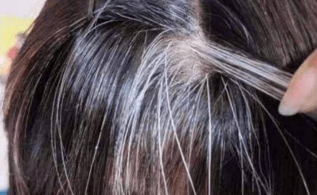 头发白缺什么微量元素（缺微量头发元素白发会多吗）-硒宝网