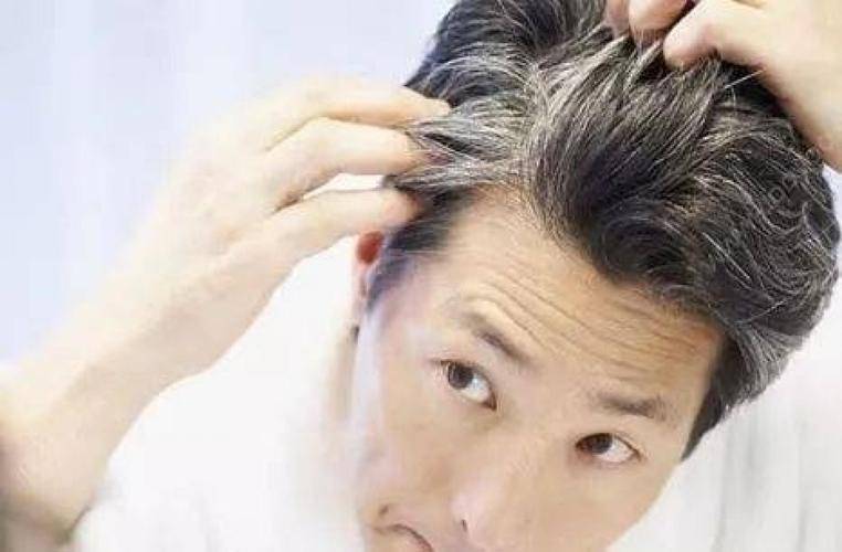 头发白缺什么微量元素（缺微量头发元素白发会多吗）-硒宝网