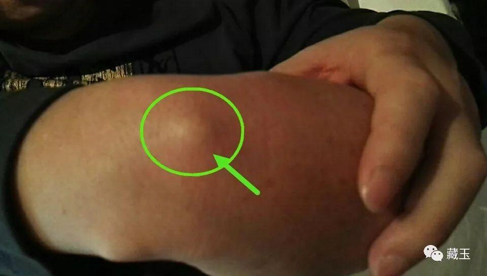 带硒的玉石能补硒吗(含硒玉石)-硒宝网