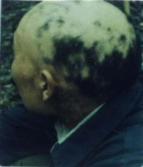 癌症补硒怎么补的好（癌症病人补硒的骗局）-硒宝网