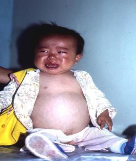 癌症补硒怎么补的好（癌症病人补硒的骗局）-硒宝网