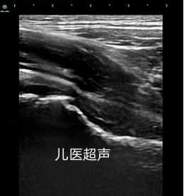 为什么不建议做微量元素检查（微量元素检查建议做什么检查）-硒宝网