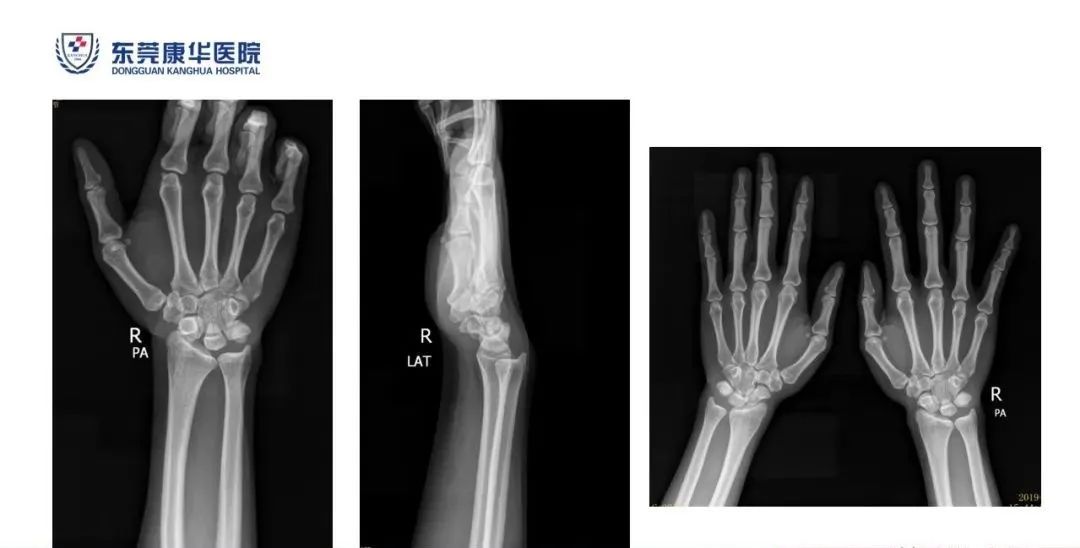 为什么不建议做微量元素检查（微量元素检查建议做什么检查）-硒宝网