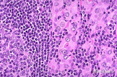 甲状腺结节补硒好吗(甲状腺结节补硒有好处吗)-硒宝网