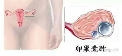 肿瘤患者补硒 研究(在肿瘤治疗中补充硒元素)-硒宝网