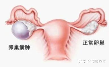 肿瘤患者补硒 研究(在肿瘤治疗中补充硒元素)-硒宝网