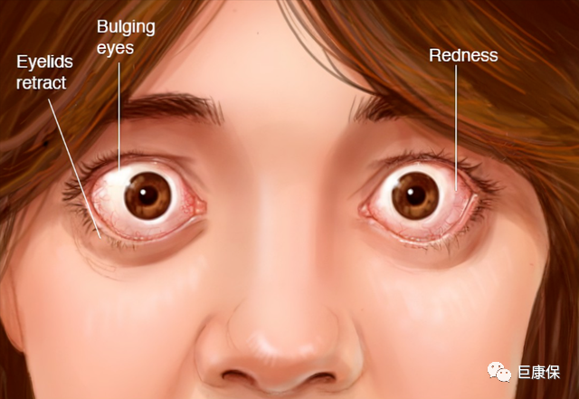 为啥要补硒 甲状腺（甲状腺补硒）-硒宝网