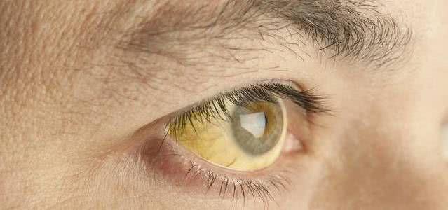 眼睛疲劳 需要补硒（眼睛疲劳要吃维生素哪种）-硒宝网