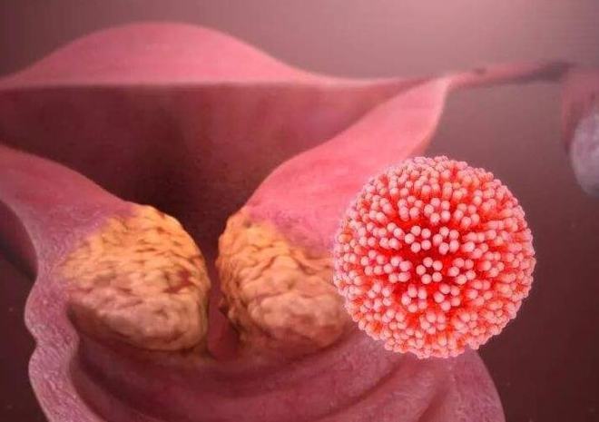 补硒用量hpv患者(hpv感染补硒用量)-硒宝网