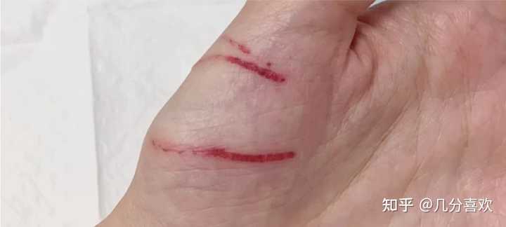 hpv感染高危补硒（hpv高危补硒有用吗）-硒宝网