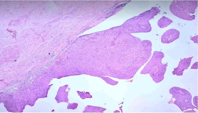 hpv阳性补什么硒（hpv阳性补硒的剂量）-硒宝网
