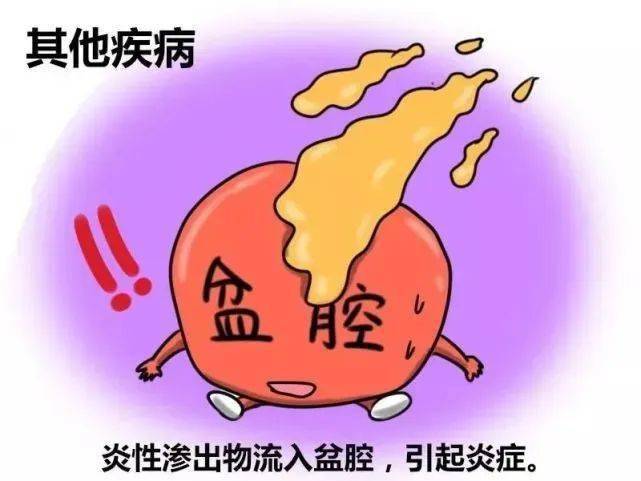 hpv阳性补什么硒（hpv阳性补硒的剂量）-硒宝网