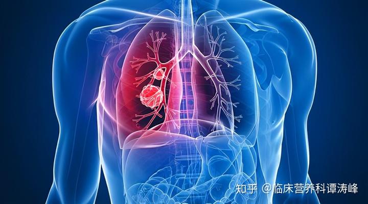 肺癌晚期补硒400（晚期肺癌补硒400克）-硒宝网