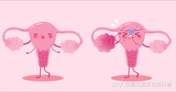 补硒元素清除hpv(硒元素治疗hpv)-硒宝网