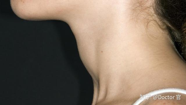 甲状腺患者补硒好吗（补甲状腺患者好硒片吗）-硒宝网