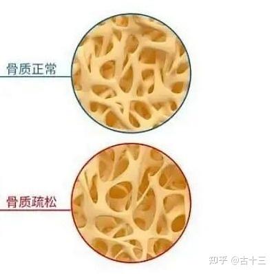 中年人补钙(补钙中年人)-硒宝网