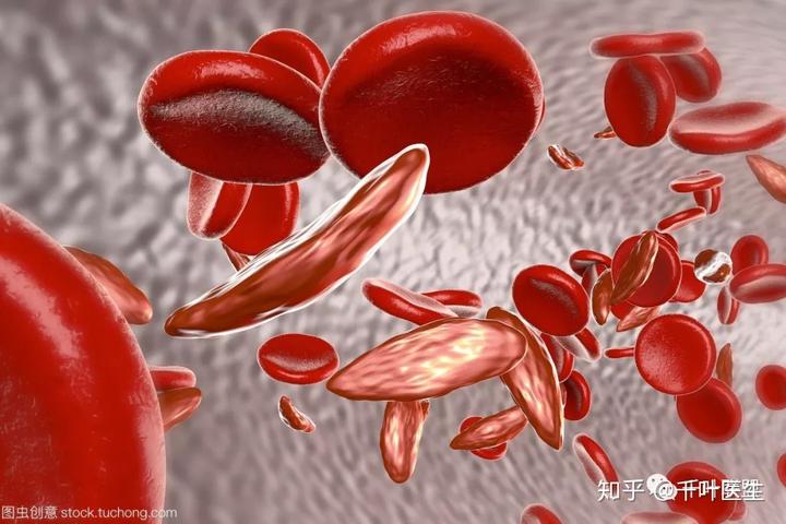 女性补铁（女性补铁的药物有哪些）-硒宝网