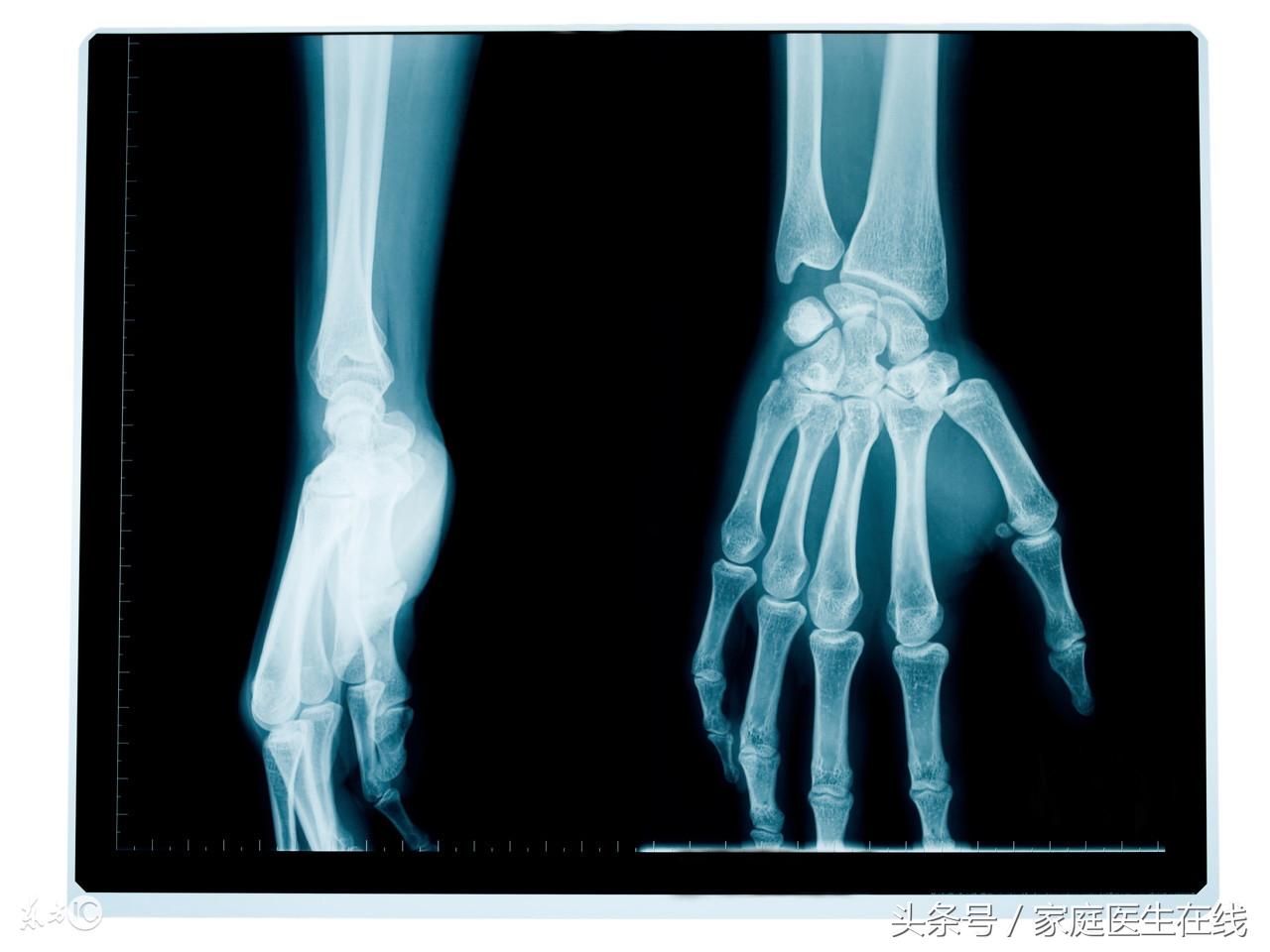 吃什么东西补钙(补充钙的东西)-硒宝网