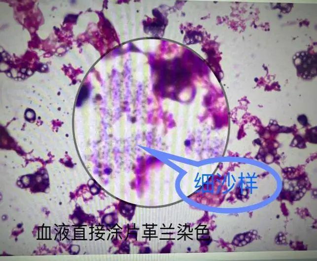 微量元素检测需要空腹么（微量元素检测空腹）-硒宝网