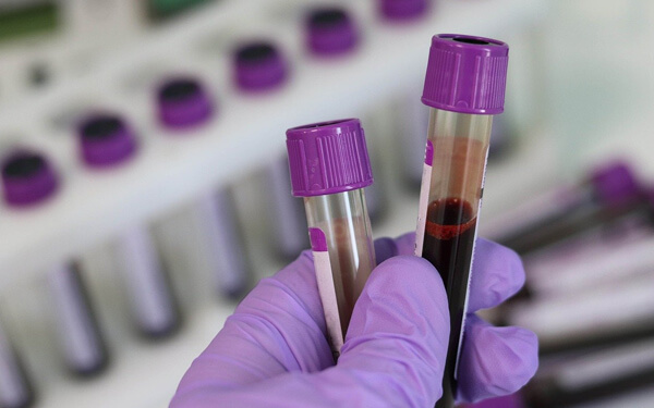 微量元素检测需要空腹么（微量元素检测空腹）-硒宝网