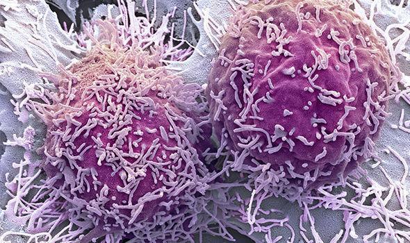 微量元素检测需要空腹么（微量元素检测空腹）-硒宝网