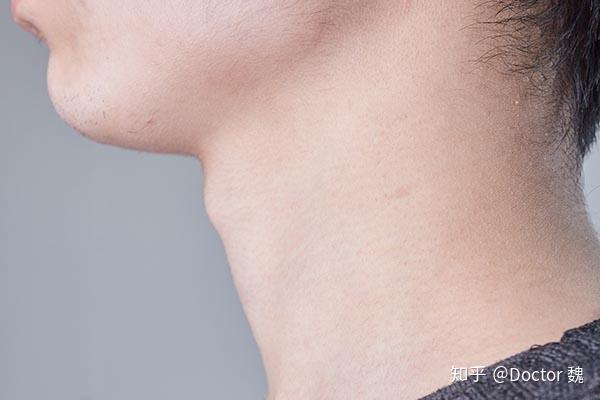 甲亢医生建议补硒吗(甲亢病人补硒)-硒宝网