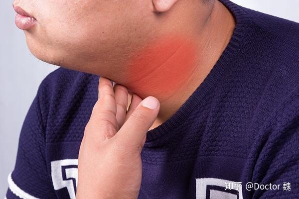 甲亢医生建议补硒吗(甲亢病人补硒)-硒宝网