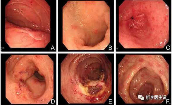 iga肾病能补硒吗（肾病可以吃硒元素吗）-硒宝网