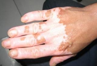 微量元素检测需要空腹么（空腹微量元素检测需要空腹几天）-硒宝网