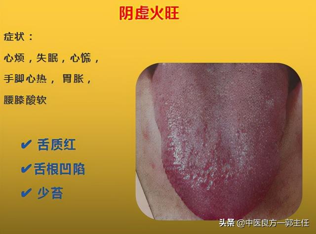 红枣补铁（红枣补铁补血吗）-硒宝网