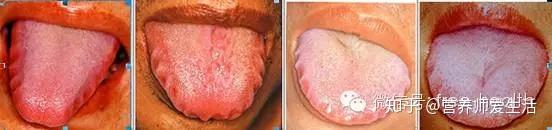 吃多少食物可以补硒(补食物吃硒可以长高吗)-硒宝网