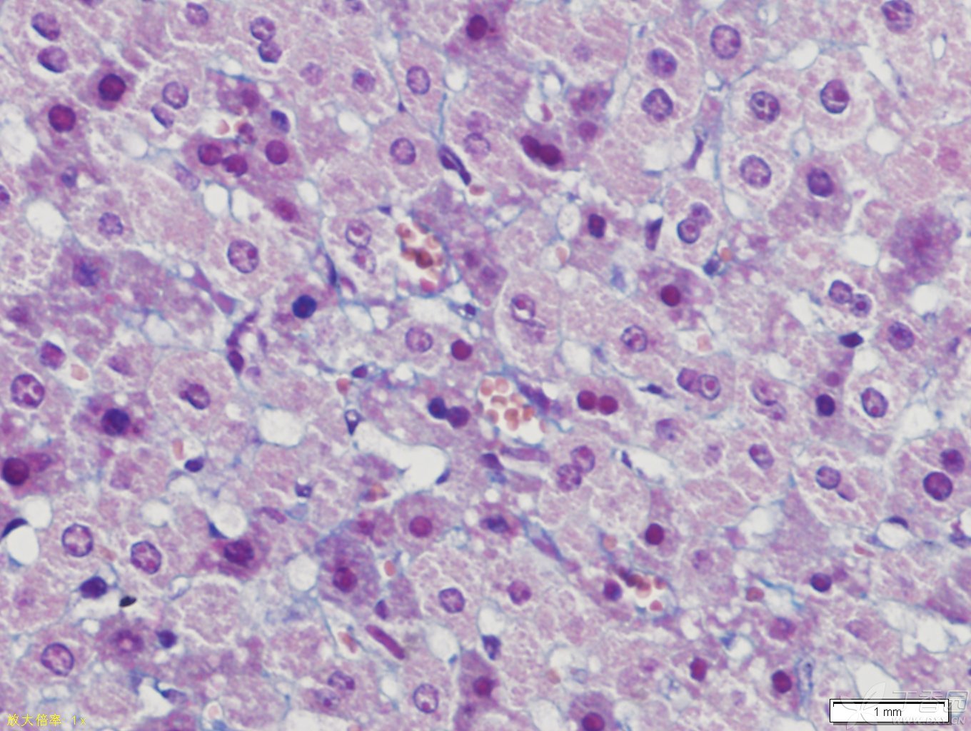 人体每天补硒应多少（每天人体补应硒多少克）-硒宝网