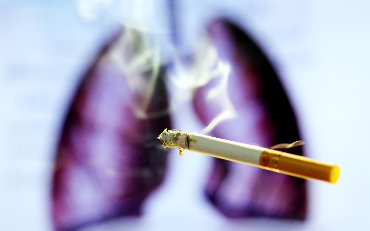 肺腺癌患者如何补硒(肺腺癌补硒的作用)-硒宝网