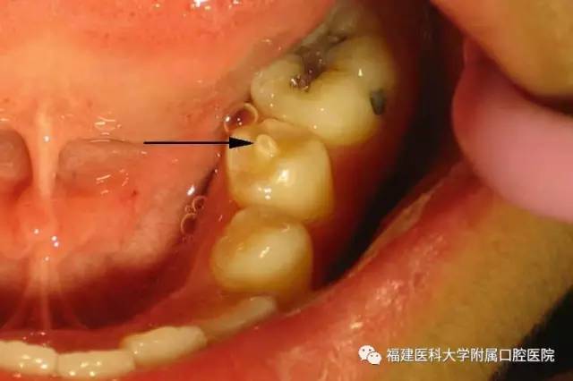 八个月宝宝怎么补钙(宝宝补钙成功有什么表现)-硒宝网