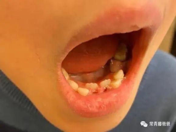 八个月宝宝怎么补钙(宝宝补钙成功有什么表现)-硒宝网