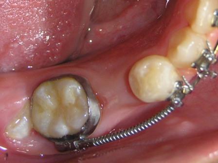 八个月宝宝怎么补钙(宝宝补钙成功有什么表现)-硒宝网