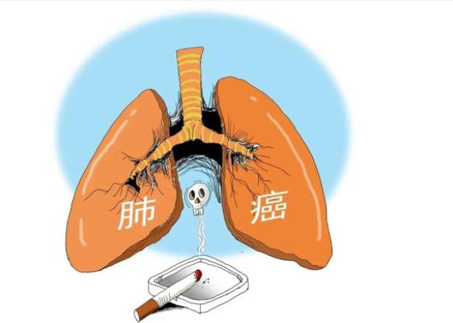 肺腺癌患者如何补硒(补硒肺癌)-硒宝网