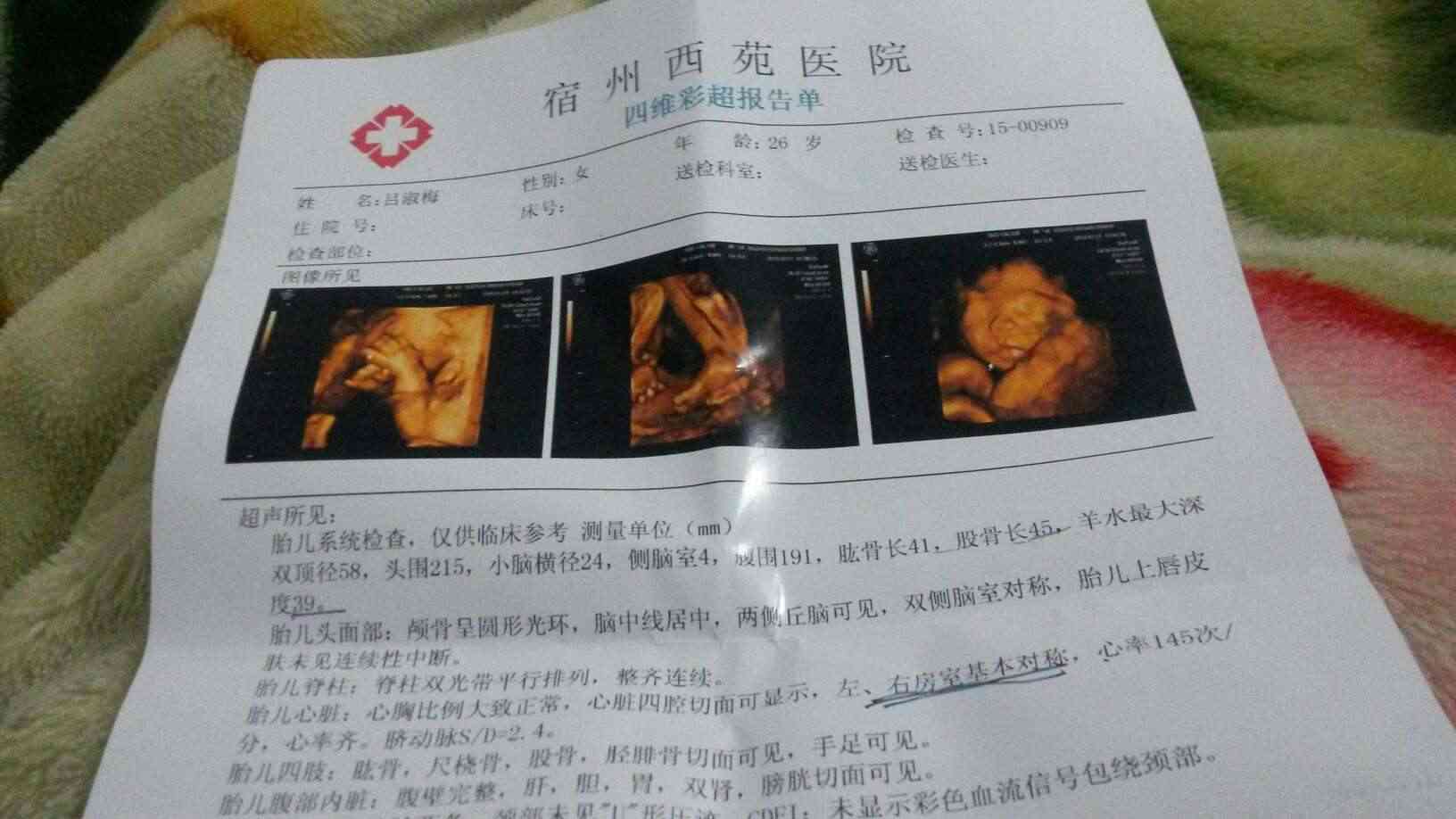 怎样判断补钙过量（过量补钙判断依据）-硒宝网