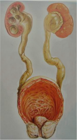 补硒能治hpv 吗(补硒能去除hpv病毒吗)-硒宝网