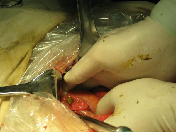 补硒能治hpv 吗(补硒能去除hpv病毒吗)-硒宝网