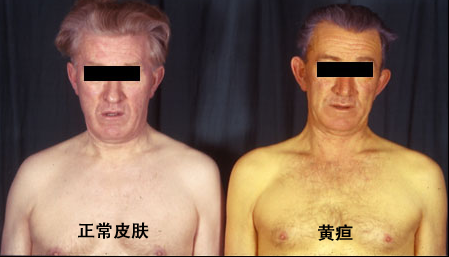 晚期癌症吃什么补硒（癌症晚期服用硒每天多少量）-硒宝网