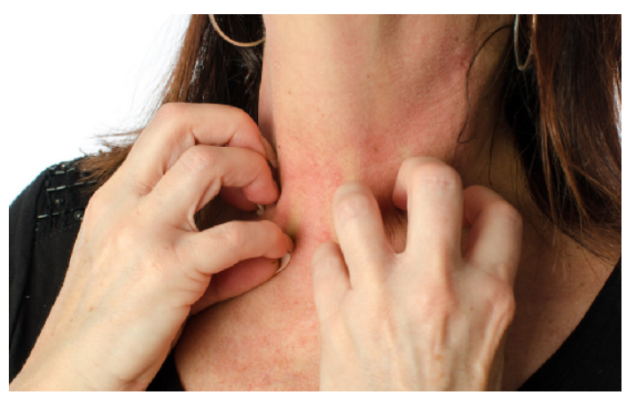 hpv阳性要补硒吗(hpv阳性补充硒会有效果吗)-硒宝网