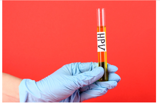 hpv阳性要补硒吗(hpv阳性补充硒会有效果吗)-硒宝网