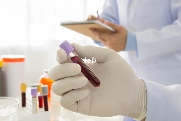 微量元素检查需要空腹吗(空腹微量元素检查需要空腹多久)-硒宝网