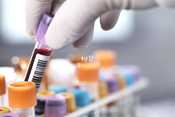 微量元素检查需要空腹吗(空腹微量元素检查需要空腹多久)-硒宝网